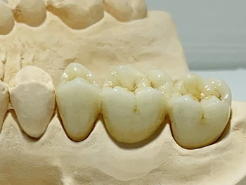 Hambaravi tsirkooniumoksiid plokid AG71mm HT plokke Amann girrbach CAD-CAM süsteemi dental labor